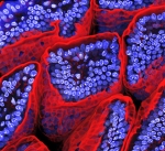 Células epiteliales de intestino de ratón con Microvilli